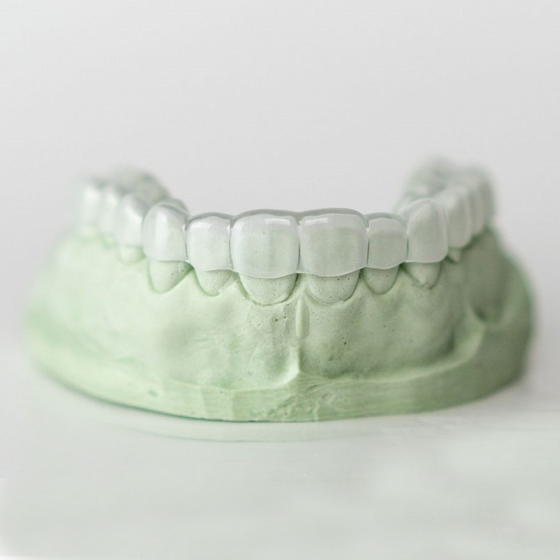 Waarom zou u een orthodontische behandeling moeten ondergaan?