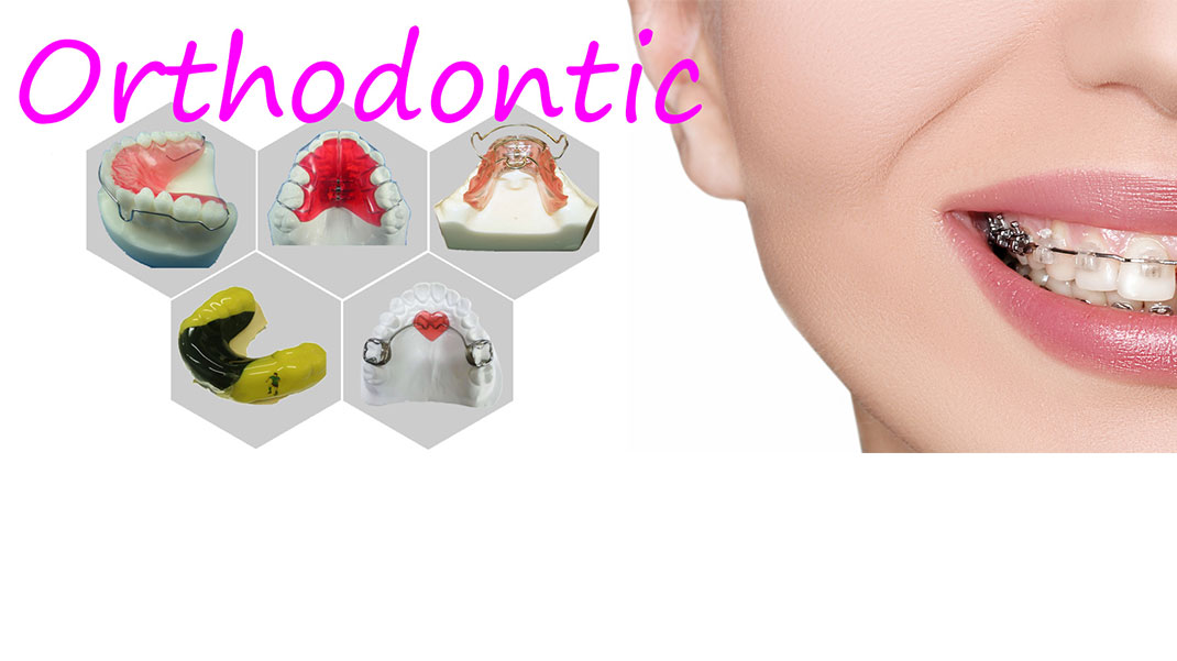 Orthodontisch