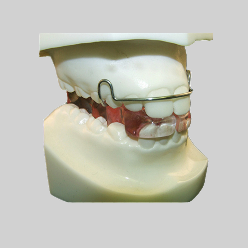 Wat is het verschil tussen orthodontie en orthodontische behandeling?