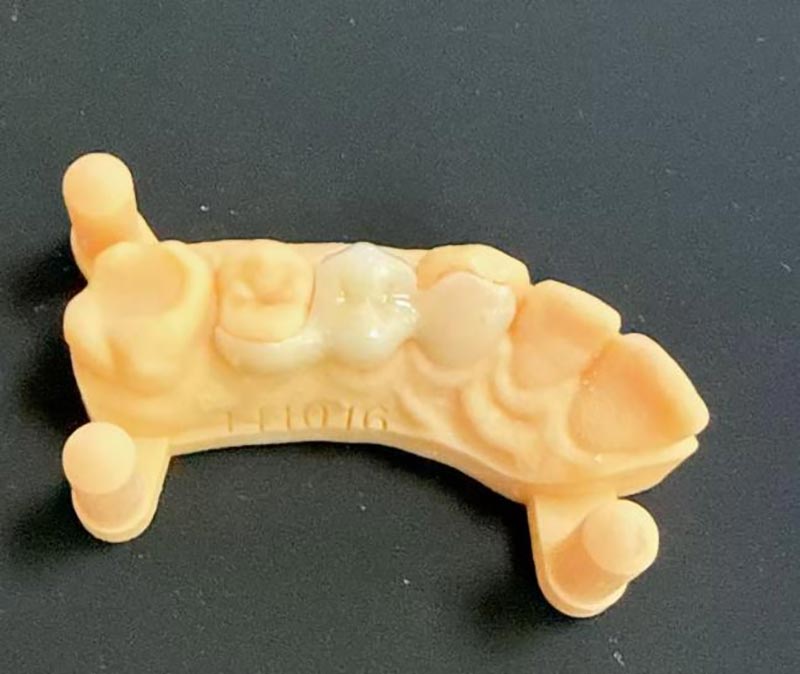 Wat u moet weten over Maryland-bruggen?