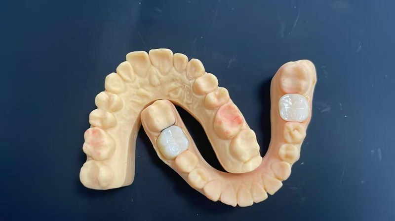 Wat is de schouderrand?