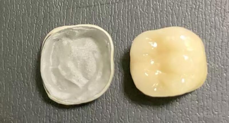 WM DENTAL LAB – Een toonaangevend Chinees tandtechnisch laboratorium