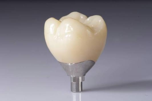 Optimaliseer uw resultaten met zirkonia-restauraties (kronen, bruggen, implantaten)
