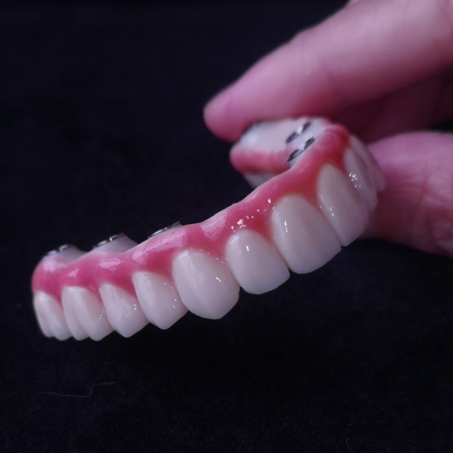 All On X Hybrid Bridge - Volledige Zirconia-brug over Tibases