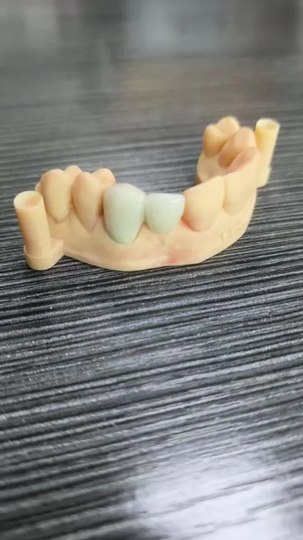 Removable