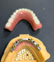 Locator en tandartsstaaf