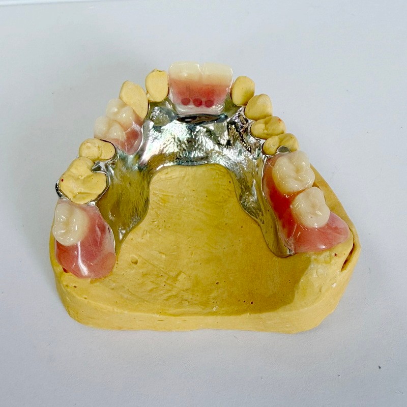 Verwijderbaar restauratie gedeeltelijk raamwerk